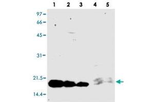 Western blot analysis of PCSK9 (prodomain) monoclonal antibody, clone KS-2C8 . (PCSK9 antibody)