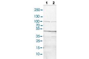 Western blot analysis of Lane 1: NIH/3T3 cell lysate and Lane 2: NBT-II cell lysate with CD36 polyclonal antibody .