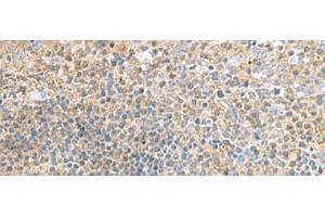 Immunohistochemistry of paraffin-embedded Human tonsil tissue using TSTA3 Polyclonal Antibody at dilution of 1:45(x200) (TSTA3 antibody)