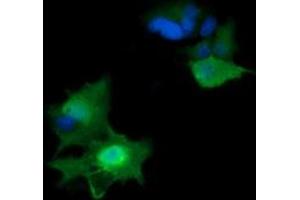 Image no. 2 for anti-HRas proto-oncogene, GTPase (HRAS) antibody (ABIN1498715)