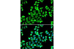 Immunofluorescence analysis of A549 cells using CDC16 antibody.