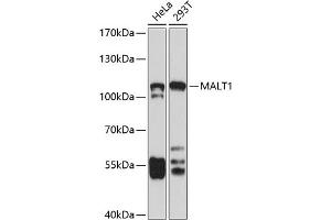 Western blot analysis of extracts of various cell lines, using M antibody (ABIN3023031, ABIN3023032, ABIN3023033, ABIN1513170 and ABIN6219356) at 1:1000 dilution. (MALT1 antibody  (AA 125-450))