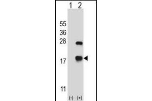 Western blot analysis of CRYAB (arrow) using rabbit polyclonal CRYAB Antibody (Center) (ABIN657620 and ABIN2846616). (CRYAB antibody  (AA 84-112))