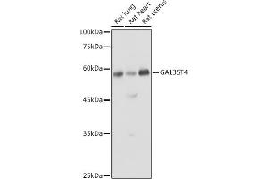 Western blot analysis of extracts of various cell lines, using GST4 antibody (ABIN6135004, ABIN6140932 and ABIN7101748) at 1:1000 dilution. (GAL3ST4 antibody)