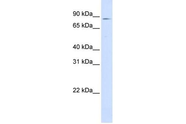 CPT1A antibody  (Middle Region)