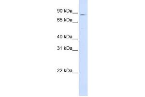 WB Suggested Anti-CPT1A Antibody Titration:  0. (CPT1A antibody  (Middle Region))