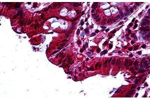 Human Colon: Formalin-Fixed, Paraffin-Embedded (FFPE) (TAB2 antibody  (AA 161-173))