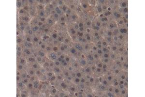 Used in DAB staining on fromalin fixed paraffin- embedded liver tissue (NR1I3 antibody  (AA 1-247))