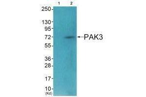 Western blot analysis of extracts from HeLa cells (Lane 2), using PAK3 (Ab-154) antiobdy. (PAK3 antibody  (Ser154))