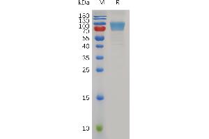 Mouse B7-1 Protein, hFc Tag on SDS-PAGE under reducing condition.
