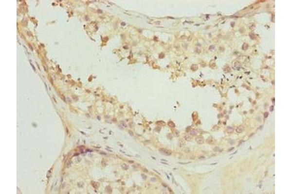 FAM113A antibody  (AA 6-312)