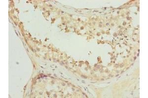 Immunohistochemistry of paraffin-embedded human testis tissue using ABIN7162706 at dilution of 1:100 (FAM113A antibody  (AA 6-312))