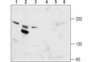 Western blot analysis of rat kidney (lanes 1 and 4), rat testis (lanes 2 and 5) and mouse kidney (lanes 3 and 6) lysates: - 1-3. (TRPM6 antibody  (1st Extracellular Loop))