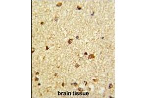 Immunohistochemistry (Paraffin-embedded Sections) (IHC (p)) image for anti-Core-Binding Factor, beta Subunit (CBFB) (AA 61-90) antibody (ABIN390892)