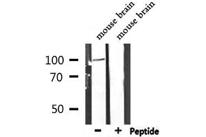 Western blot analysis of extracts from mouse brain, using DLG1 Antibody. (DLG1 antibody  (Internal Region))