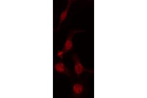 ABIN6274233 staining Hela cells by IF/ICC. (GTF2H1 antibody  (N-Term))