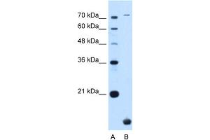 WB Suggested Anti-TMEM91 Antibody Titration:  0. (TMEM91 antibody  (N-Term))