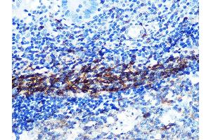 Immunohistochemistry (IHC) image for anti-CD79b Molecule, Immunoglobulin-Associated beta (CD79B) antibody (ABIN1682474)