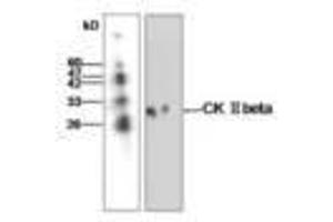 Image no. 1 for anti-Casein Kinase 2, beta (CSNK2B) antibody (ABIN791462) (CSNK2B antibody)
