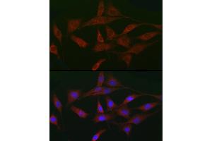 Immunofluorescence analysis of NIH/3T3 cells using A Rabbit pAb (ABIN3015791, ABIN3015792, ABIN3015793 and ABIN6219141) at dilution of 1:50 (40x lens). (ACVR2A antibody  (AA 20-140))