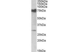 AP31405PU-N NMNAT3 antibody staining of Mouse Heart lysate at 0. (NMNAT3 antibody  (Internal Region))