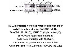 Image no. 2 for anti-Fanconi Anemia, Complementation Group D2 (FANCD2) (AA 217-226), (pSer222) antibody (ABIN363448) (FANCD2 antibody  (pSer222))