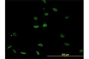 Immunofluorescence of monoclonal antibody to PSMB8 on HeLa cell. (PSMB8 antibody  (AA 173-272))