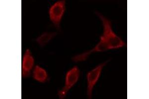 ABIN6274647 staining LOVO cells by IF/ICC. (Cytochrome P450 2C8/9/18/19 antibody)