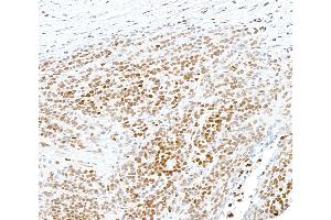 anti-SAM Domain and HD Domain 1 (SAMHD1) (AA 576-626) antibody