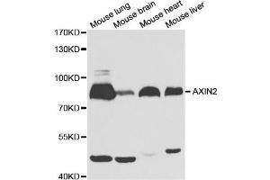 Western Blotting (WB) image for anti-Axin 2 (AXIN2) antibody (ABIN1875444)