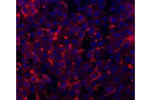 IF analysis of TAPA1/CD81 using anti-TAPA1/CD81 antibody (ABIN5693258).