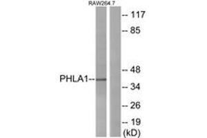 Western blot analysis of extracts from RAW264. (PHLDA1 antibody  (AA 271-320))