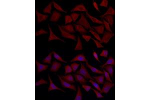 Immunofluorescence analysis of HeLa cells using TLR4 Rabbit pAb (ABIN6134489, ABIN6149223, ABIN6149226 and ABIN6220893) at dilution of 1:100 (40x lens). (TLR4 antibody  (AA 500-600))