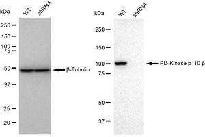 Western blotting analysis using PI3 Kinase p110 beta antibody (ABIN7799817). (Recombinant PIK3CB antibody)