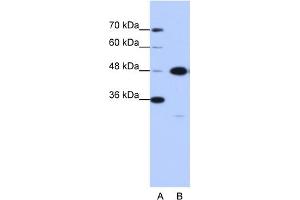 WB Suggested Anti-GTPBP9 Antibody Titration:  0. (OLA1 antibody  (N-Term))