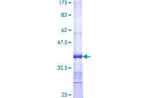 ALAS2 Protein (AA 1-100) (GST tag)