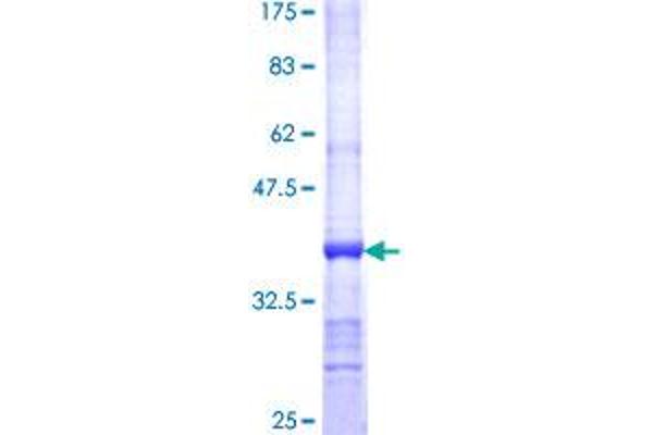 ALAS2 Protein (AA 1-100) (GST tag)