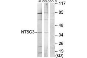 Western blot analysis of extracts from Jurkat/COLO205 cells, using NT5C3 Antibody. (NT5C3 antibody  (AA 11-60))