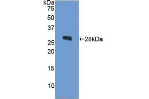 Detection of Recombinant ODC, Human using Polyclonal Antibody to Ornithine Decarboxylase (ODC) (ODC1 antibody  (AA 15-259))