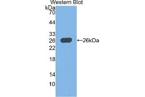 Detection of Recombinant UCHL1, Rat using Polyclonal Antibody to Ubiquitin Carboxyl Terminal Hydrolase L1 (UCHL1) (UCHL1 antibody  (AA 2-223))