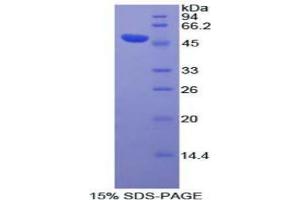 SDS-PAGE analysis of Human DVL3 Protein.