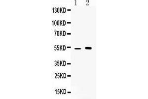 Western blot analysis of CDR2 expression in mouse kidney extract ( Lane 1) and MCF-7 whole cell lysates ( Lane 2). (CDR2 antibody  (Middle Region))
