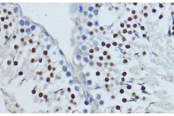 NR1I3 antibody