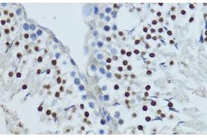 Immunohistochemistry of paraffin-embedded Rat testis using NR1I3 Polyclonal Antibody at dilution of 1:200 (40x lens).