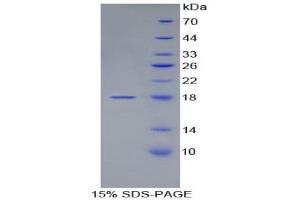 SDS-PAGE (SDS) image for Von Willebrand Factor (VWF) (AA 1498-1665) protein (His tag) (ABIN2122336)
