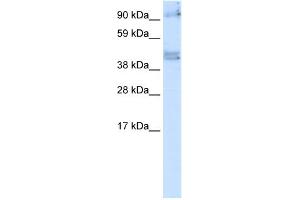 WB Suggested Anti-SIRT2 Antibody   Titration: 5 ug/ml   Positive Control: Fetal Brain (SIRT2 antibody  (N-Term))
