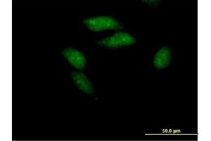 Immunofluorescence of purified MaxPab antibody to PCGF3 on HeLa cell. (PCGF3 antibody  (AA 1-242))