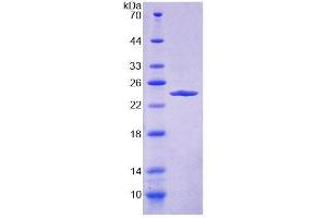 SDS-PAGE (SDS) image for Dermokine (DMKN) (AA 27-238) protein (His tag) (ABIN4991009)