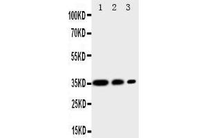 Anti-CD163 antibody,  Western blotting All lanes: Anti CD163 () at 0. (CD163 antibody  (C-Term))