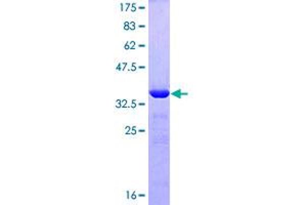 ZNF148 Protein (AA 695-794) (GST tag)